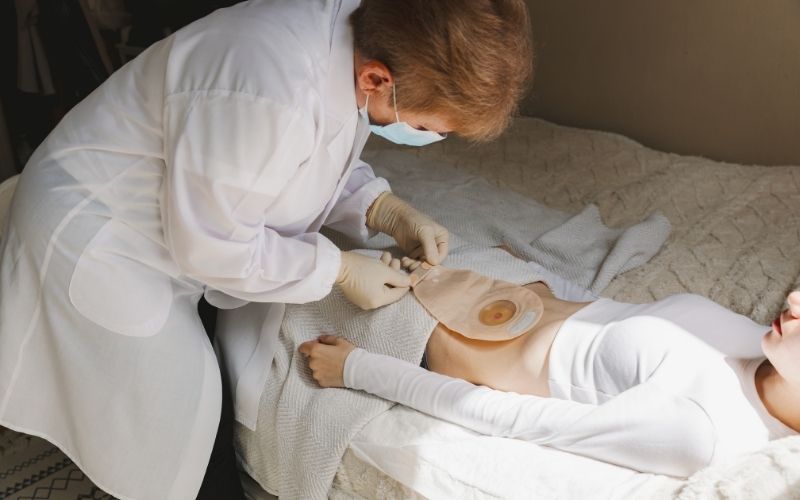 Ng - Pek Stoma Bakımı